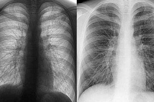 Фото - Наша газета